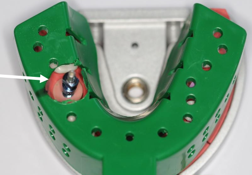 <p>What is the <strong>open tray</strong> impression technique?</p>