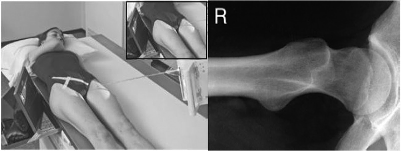 <p>What method is shown in the image?</p>