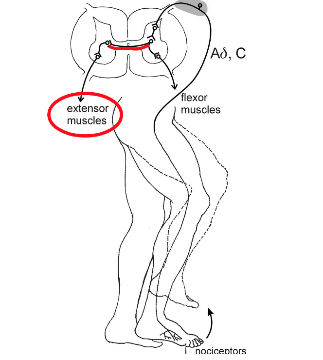 <p>Explain the third step of the cross extension reflex based on this image.</p>