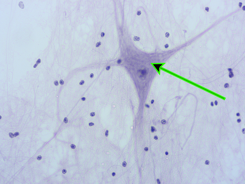 <p><em>[Quiz - Lab 2.1 (Neurophysiology and EEG): Check Your Understanding]</em></p><p><strong>ID specific cell at the end of the pointer:</strong></p><p>a. multipolar neuron</p><p>b. bipolar neuron</p><p>c. neuroglial cell</p><p>d. unipolar neuron</p>