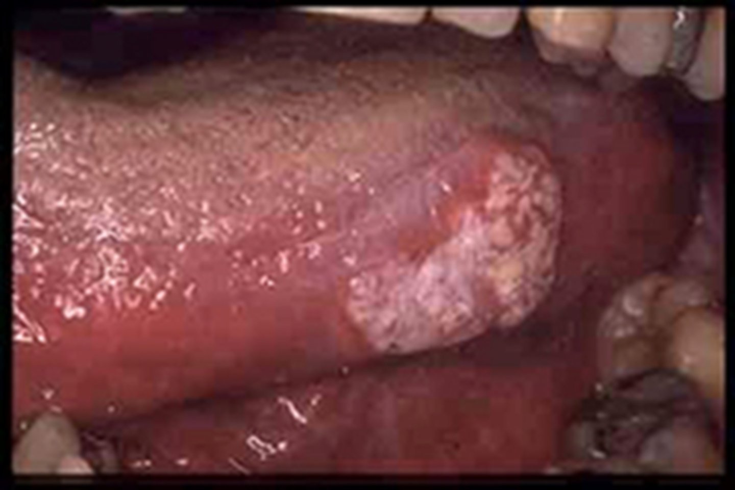 <p>if still there after 2 week, need to investigate</p><p>abnormal</p>