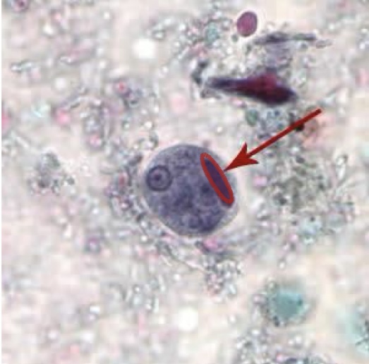 <p>Identify: Protozoa</p>