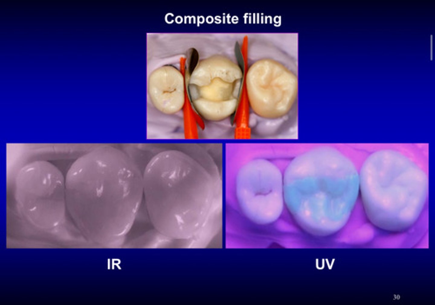 <p>UV; visible region</p>