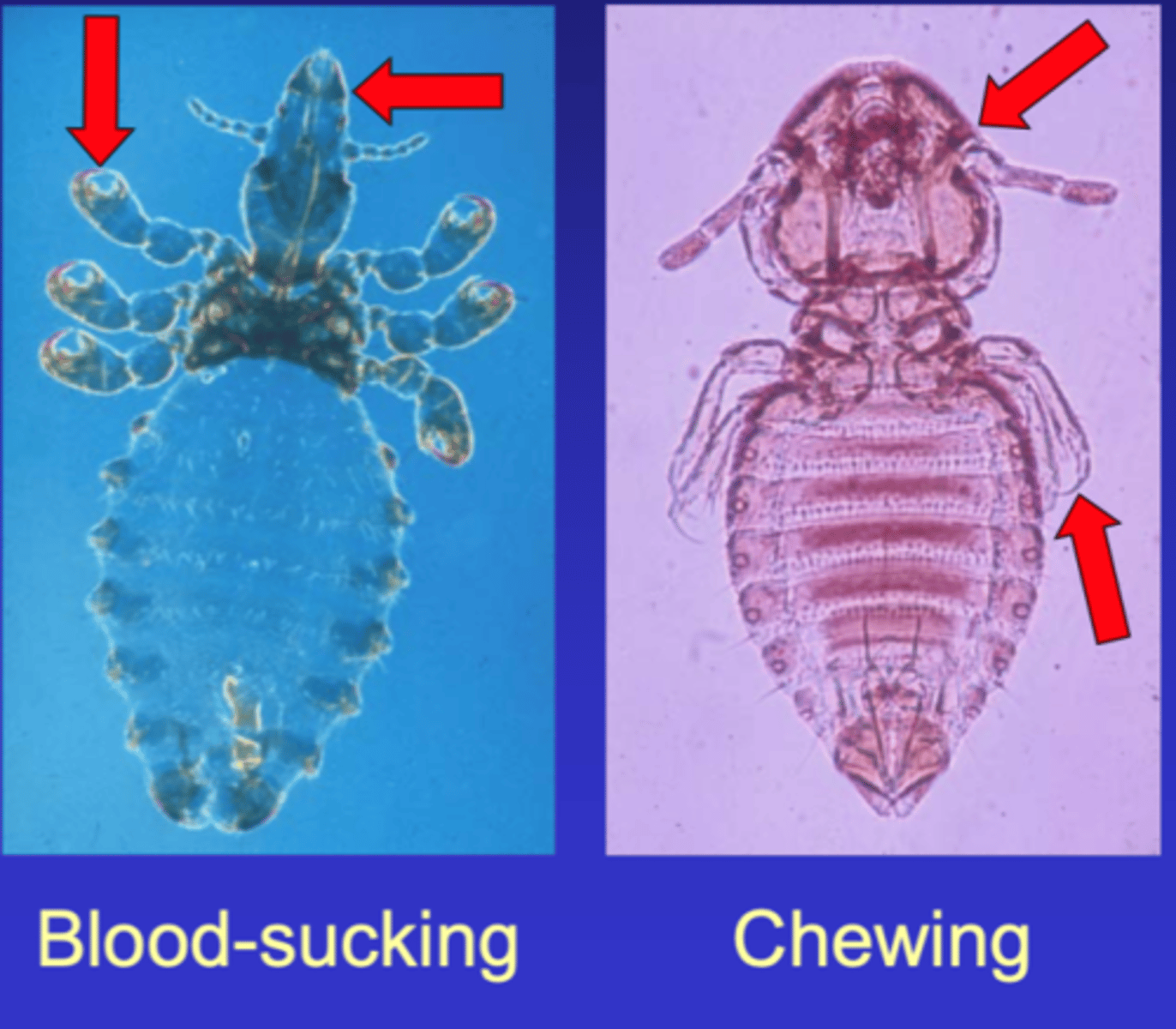 <p>Chewing/sucking lice</p>