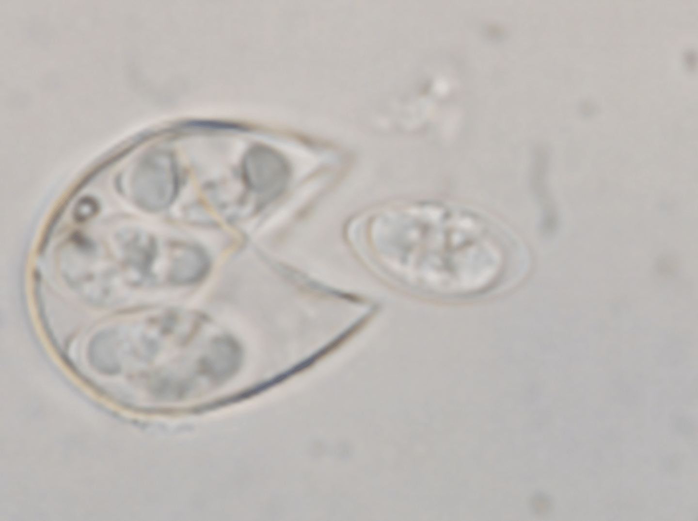 <p>Slide from a dead chicken - What parasite and life stage is this?</p>