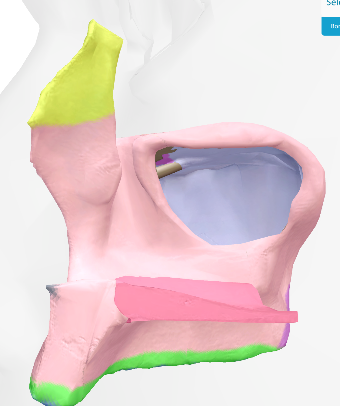 <p>hole on the underside of orbital surface of maxilla </p>