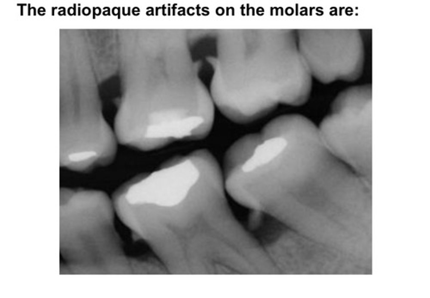 <p>anatomy is filled or outlined by POSITIVE contrast agent; appears WHITE on the radiograph</p><p>- is like bone, very solid and dense; appears white</p><p>- when we give contrast media, we are giving it that opaque look</p>