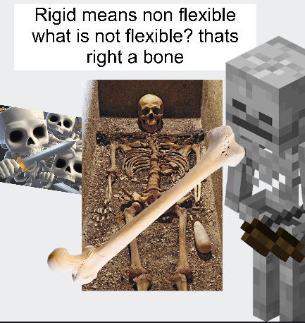 <p>Bone</p>