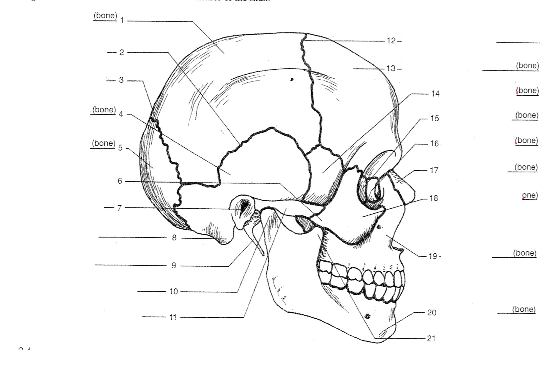 Coronoid process