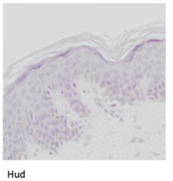 <p>Angiv epitheltypen</p>