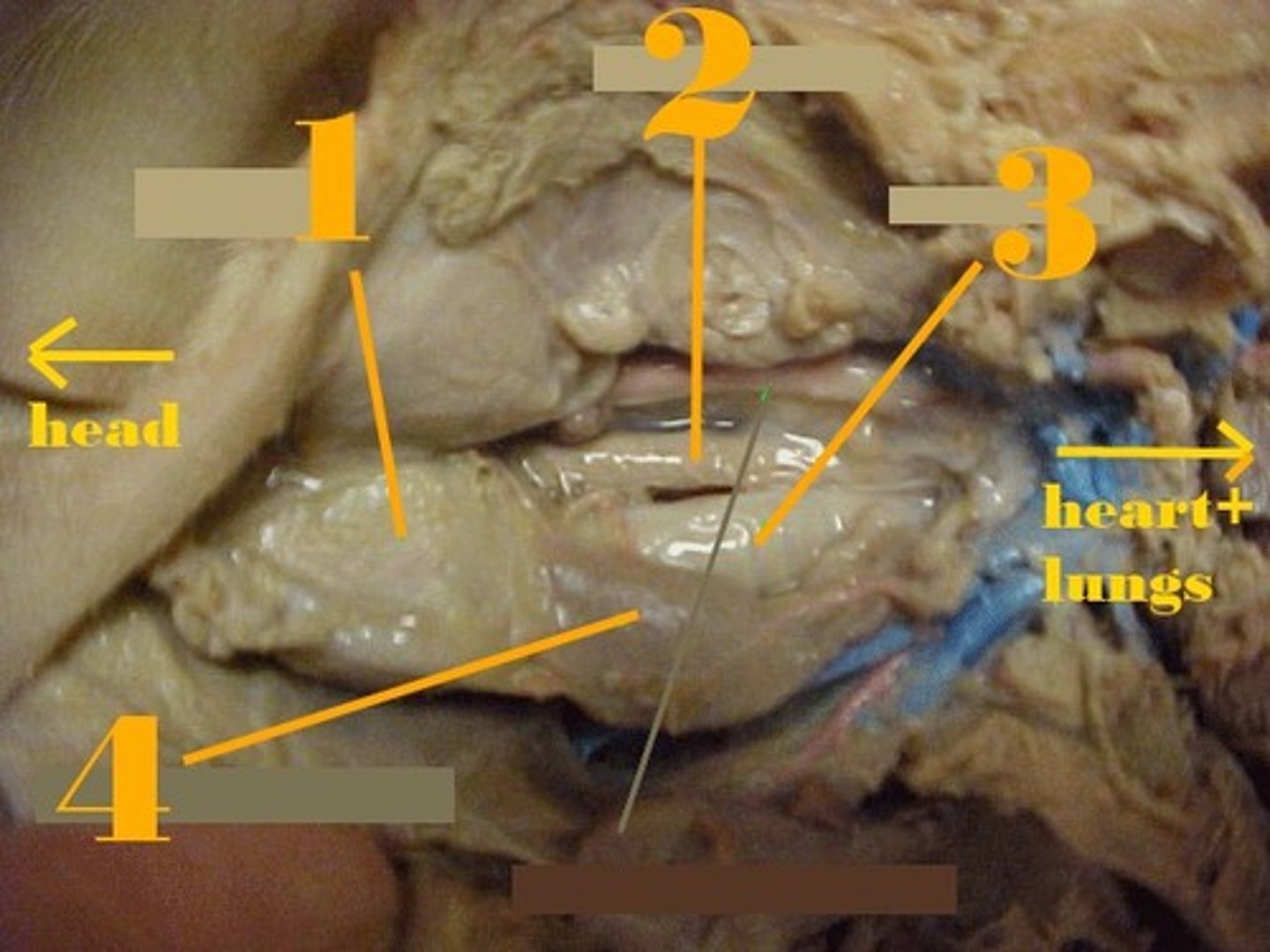 <p>#3</p>