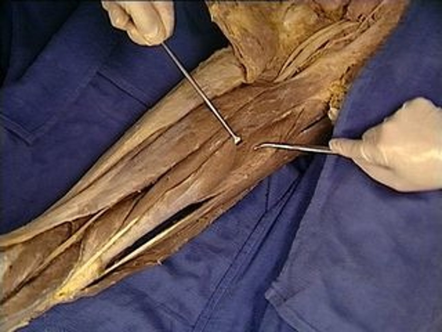 <p>Description: Below Adductor Longus; , A: adducts thigh, adductor portion flexes thigh, hamstring portion extends thigh</p>