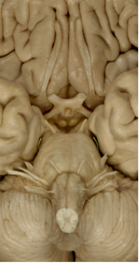 <p>Trochlear nerve (IV)</p>