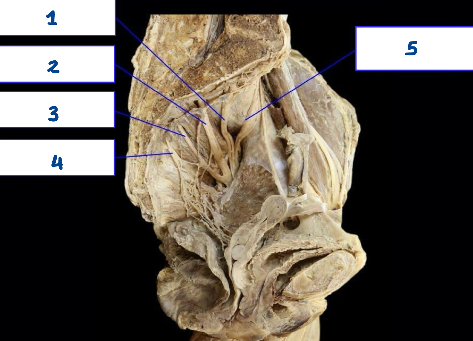 <p>What is structure 5?</p>
