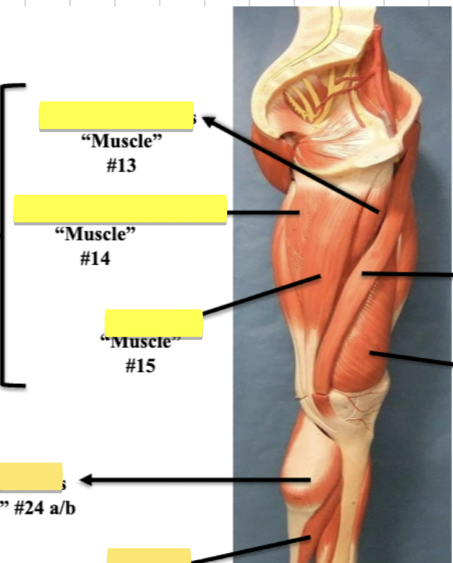 <p>Label muscle #13</p>