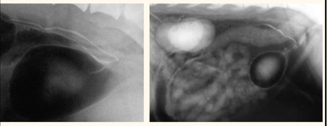<p>contrast radiography. what does this px have</p><p></p>