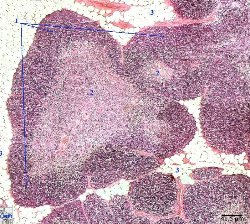 <p><strong>Thymus</strong></p><p><em>Dark outer cortex, lighter inner medulla with partitioning. Involution is occuring. Thymus being replaced by adipose tissue.</em></p>