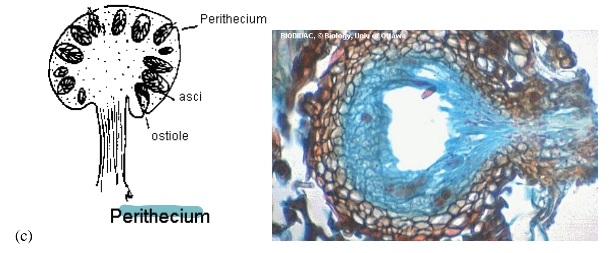 <p>ascocarp - perithecium</p>