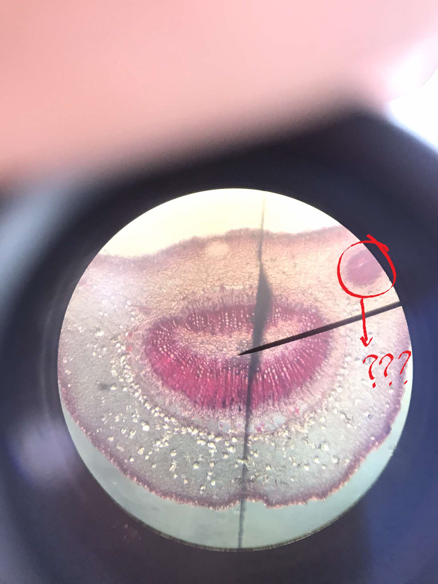 <p>the convergence of the stem and petiole</p>