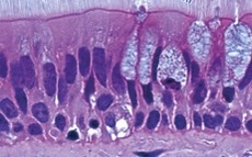 What type of epithelia?