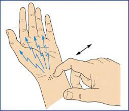 <ul><li><p><strong>carpal tunnel syndrome</strong></p></li><li><p>tap lightly over pt’s transverse carpal ligament </p></li><li><p>positive = paresthesia along distal most distribution of median nerve</p></li></ul><p></p>