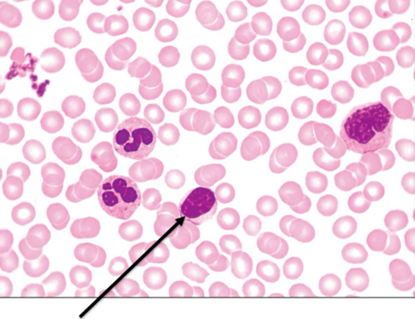 <p>second most abundant type of leukocyte AKA WBC, two sub types: b cells = make antibodies, t cells = fight infected cells, large nucli, little cytoplasm</p>