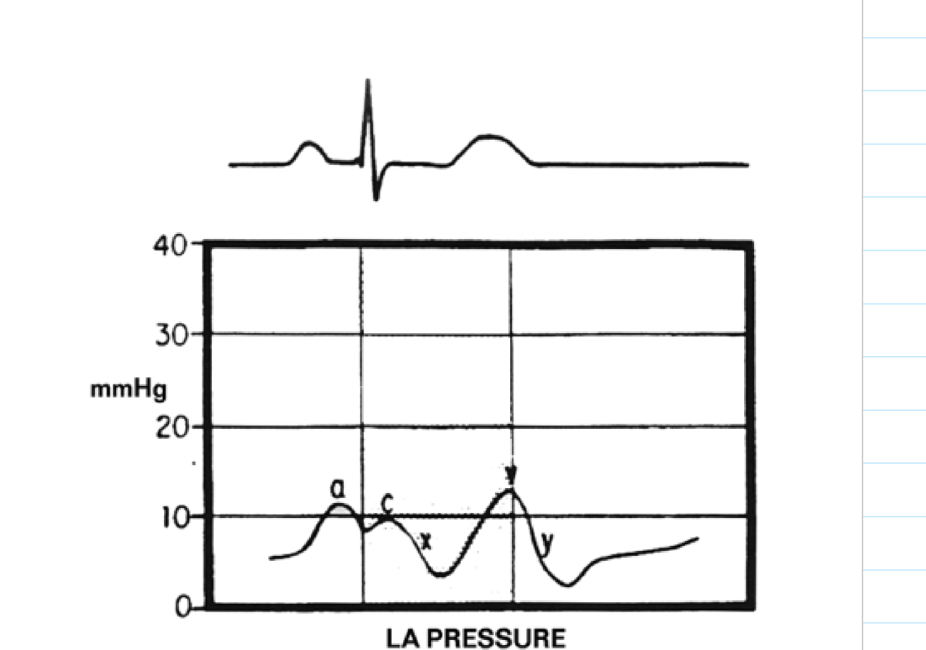 <p>label these 6 including where the pressure is being measured</p>