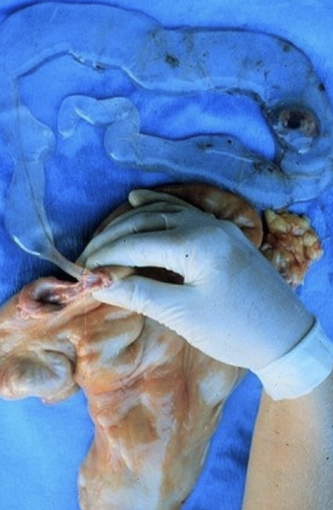 <p>-connective tissue cord on concave surface</p><p>-starts in the gravid horn at days 30-34</p><p>-will be in non-gravid horn after 50days</p>