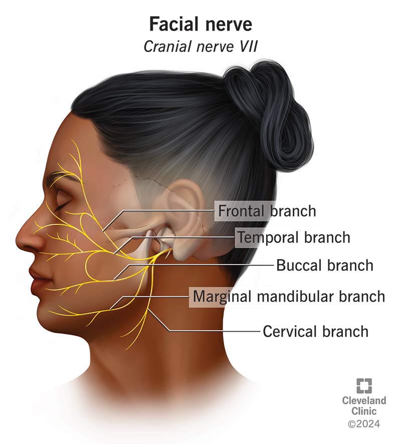 <p>Facial</p><ul><li><p>MOTOR and SENSORY</p></li><li><p>passes through <strong>internal acuoustic meatus</strong></p></li><li><p>facial expressions and blinking</p></li><li><p>salivation</p></li><li><p>taste to front 2/3 of tongue</p></li><li><p>sensory to ear</p></li></ul><p></p>