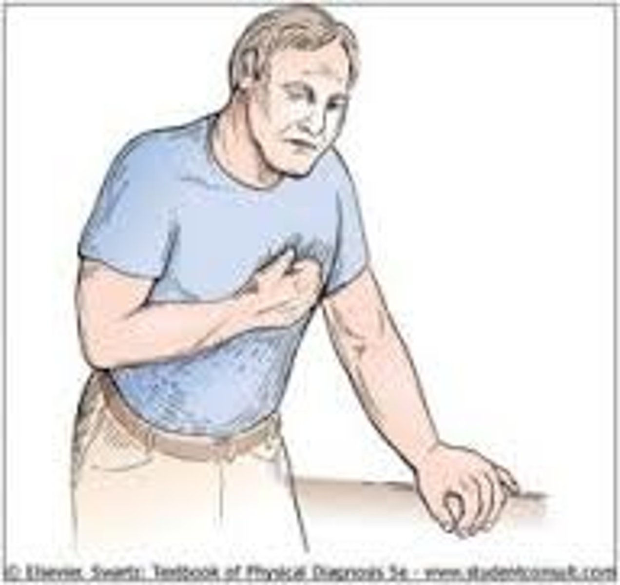 <p>the global position of heart attack; a fist clenched over the chest</p>