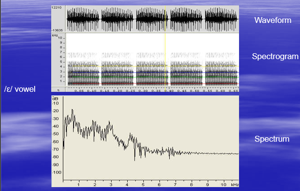 <ul><li><p>Spectral information</p></li></ul><p>Spectrum</p><p>Spectrogram </p><ul><li><p>F0 </p></li></ul><p>F0 and f0 contour</p><ul><li><p>Amplitude</p></li></ul><p>Speech intensity and intensity contour</p><ul><li><p>Duration</p></li></ul><p></p>