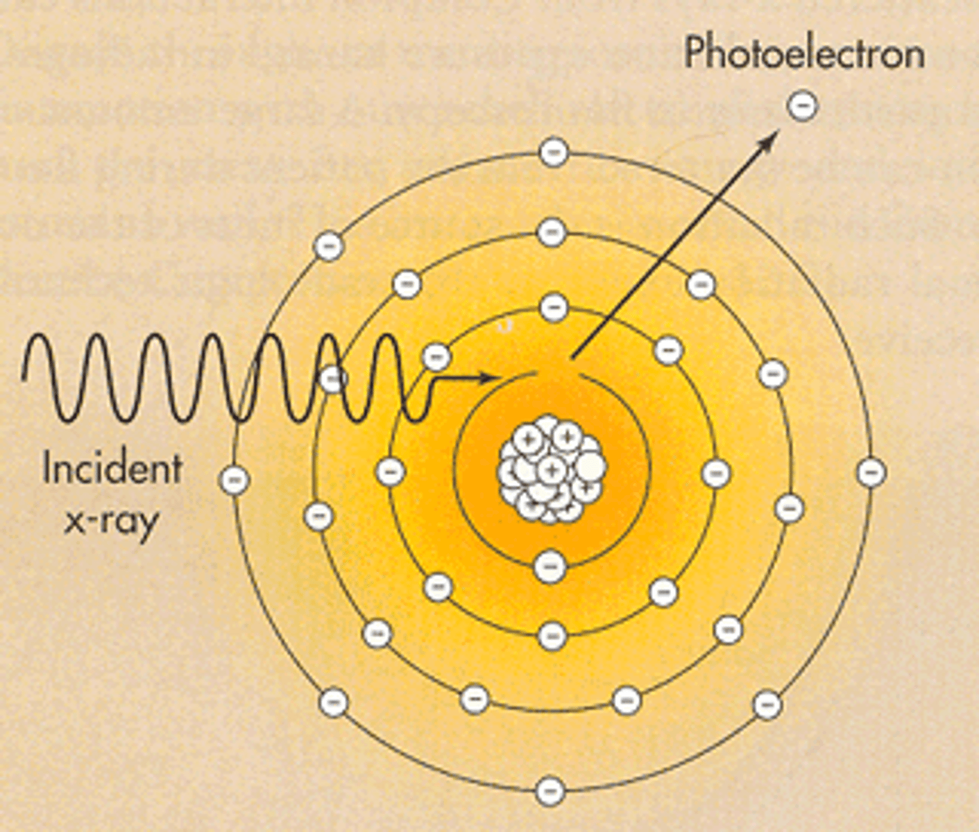 <p>This interaction:</p><p>- is considered characteristic as the incoming x-ray photon hits the k-shell electron. That electron gets ejected.</p><p>- the photon becomes COMPLETLEY ABSORBED and ceases to exist</p><p>- occurs in tissues</p><p>- results in increased dose to the patient</p><p>- k-shell hole gets fills by the other electrons in the other shells releasing low energy photons.</p><p>- this produces contrast in the radiograph because of the differential absorption of the incoming x-ray photons in the tissues</p>