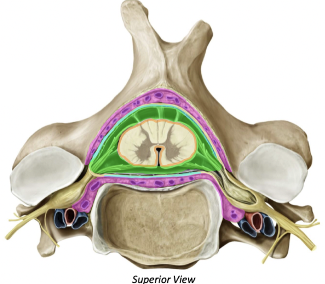 <ul><li><p>﻿﻿<span style="color: red">Epidural Space</span> </p><ul><li><p>Real space</p></li><li><p>Contains fat &amp; venous plexuses &amp; has a cushion effect</p></li><li><p>Between vertebral canal &amp; dura</p></li></ul></li><li><p>﻿﻿<span style="color: green">Subarachnoid Space</span> </p><ul><li><p>Contains CSF</p></li><li><p>Between arachnoid &amp; pia</p></li></ul></li><li><p>﻿﻿<span style="color: blue">Subdural</span> and <span style="color: yellow">Subpial</span> Spaces </p><ul><li><p>Potential spaces</p></li><li><p>Subdural is between dura &amp; arachnoid</p></li></ul></li></ul>