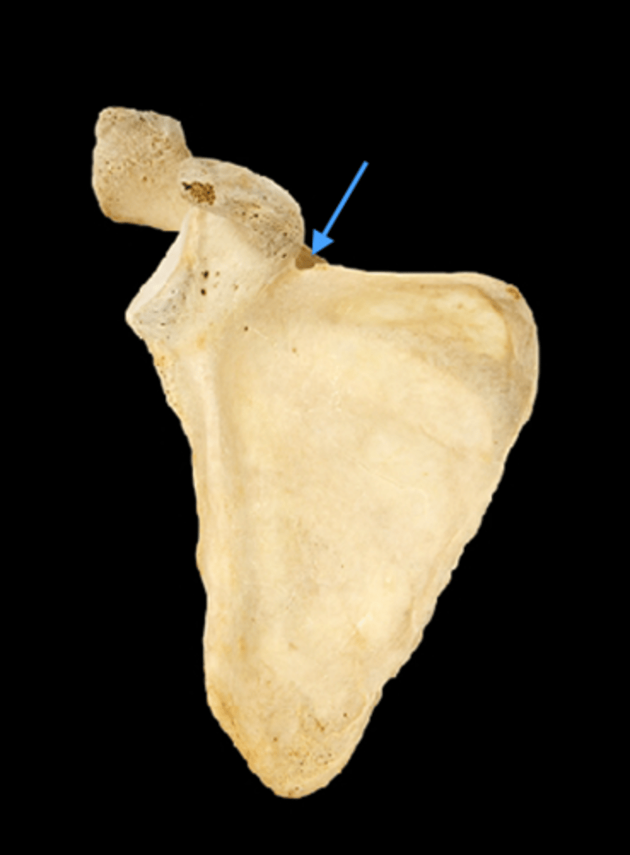 <p>identify</p>