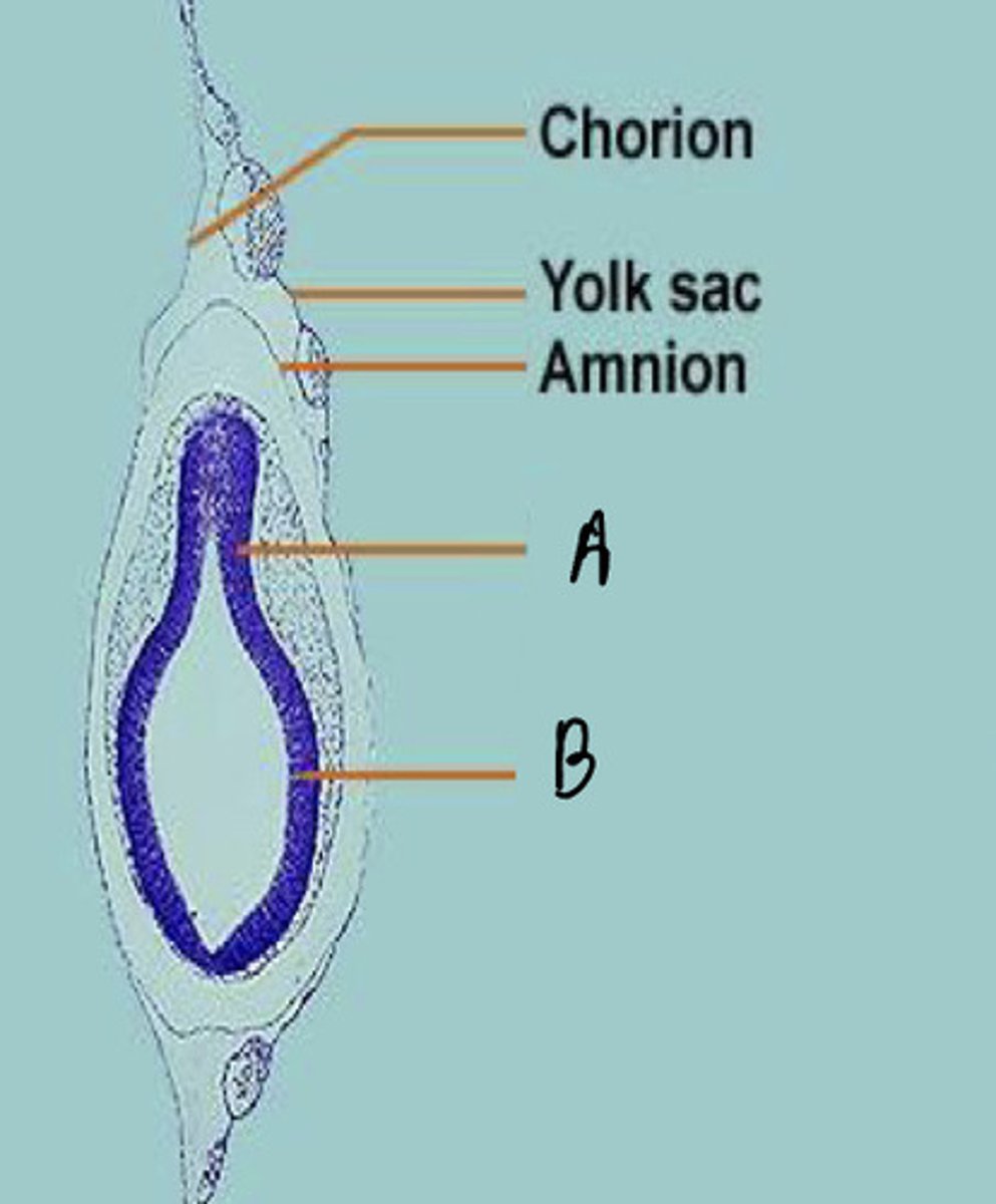 <p>B</p>