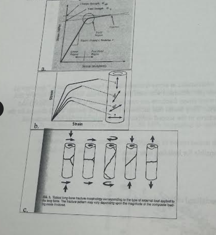<p>Which of the diagrams below best illustrates the anisotropy of cortical bone?</p>