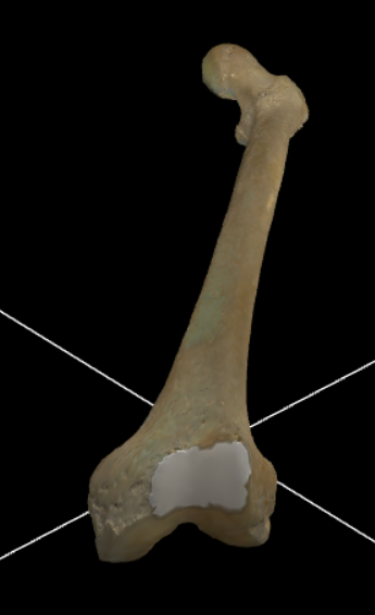 <p>Articulaire oppervlakte voor de patella op de voorzijde van de distale epifyse.</p>