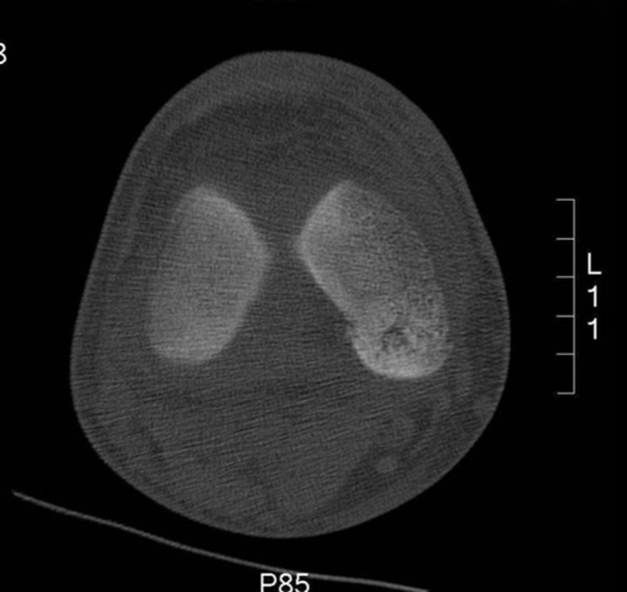 <p>What view of a CT is this?</p>