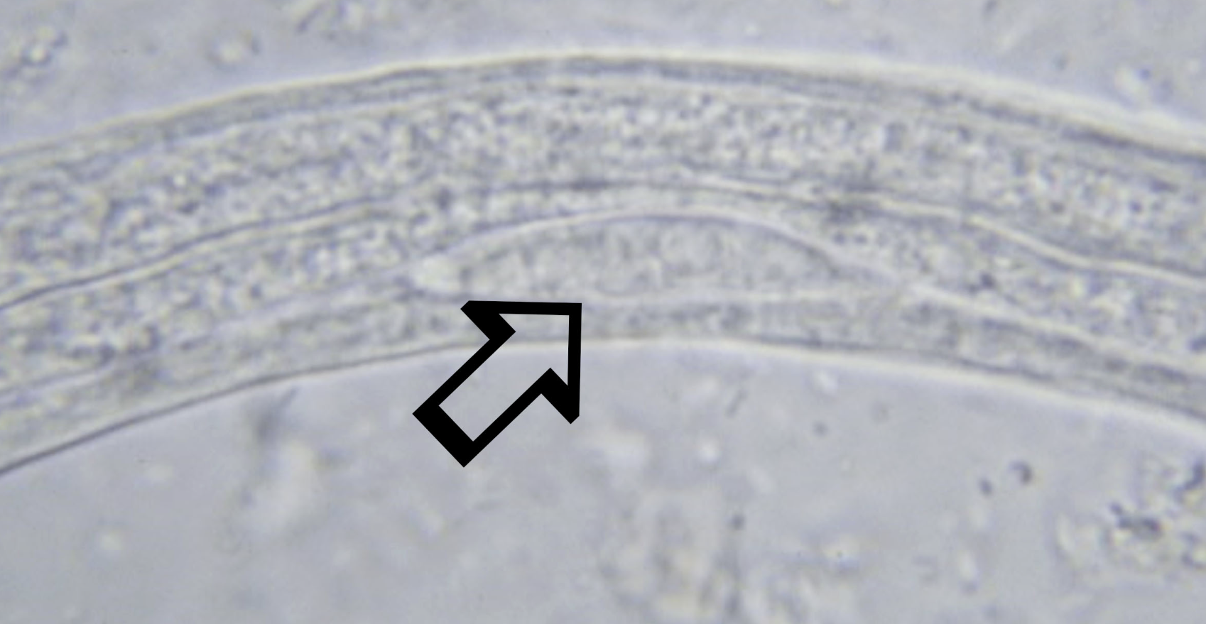 <p>What is indicated by the arrow?</p>
