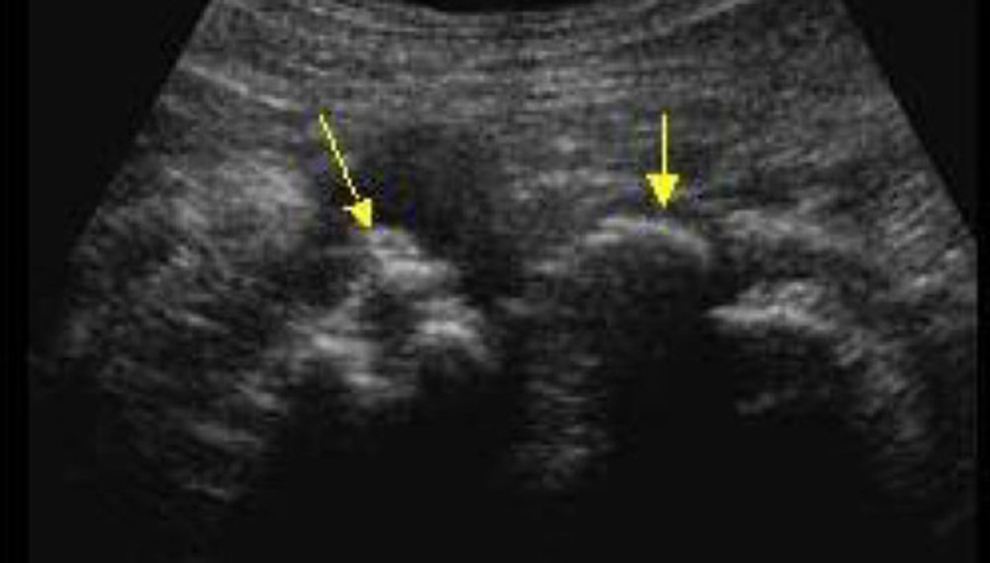 <p>What does this image show</p>