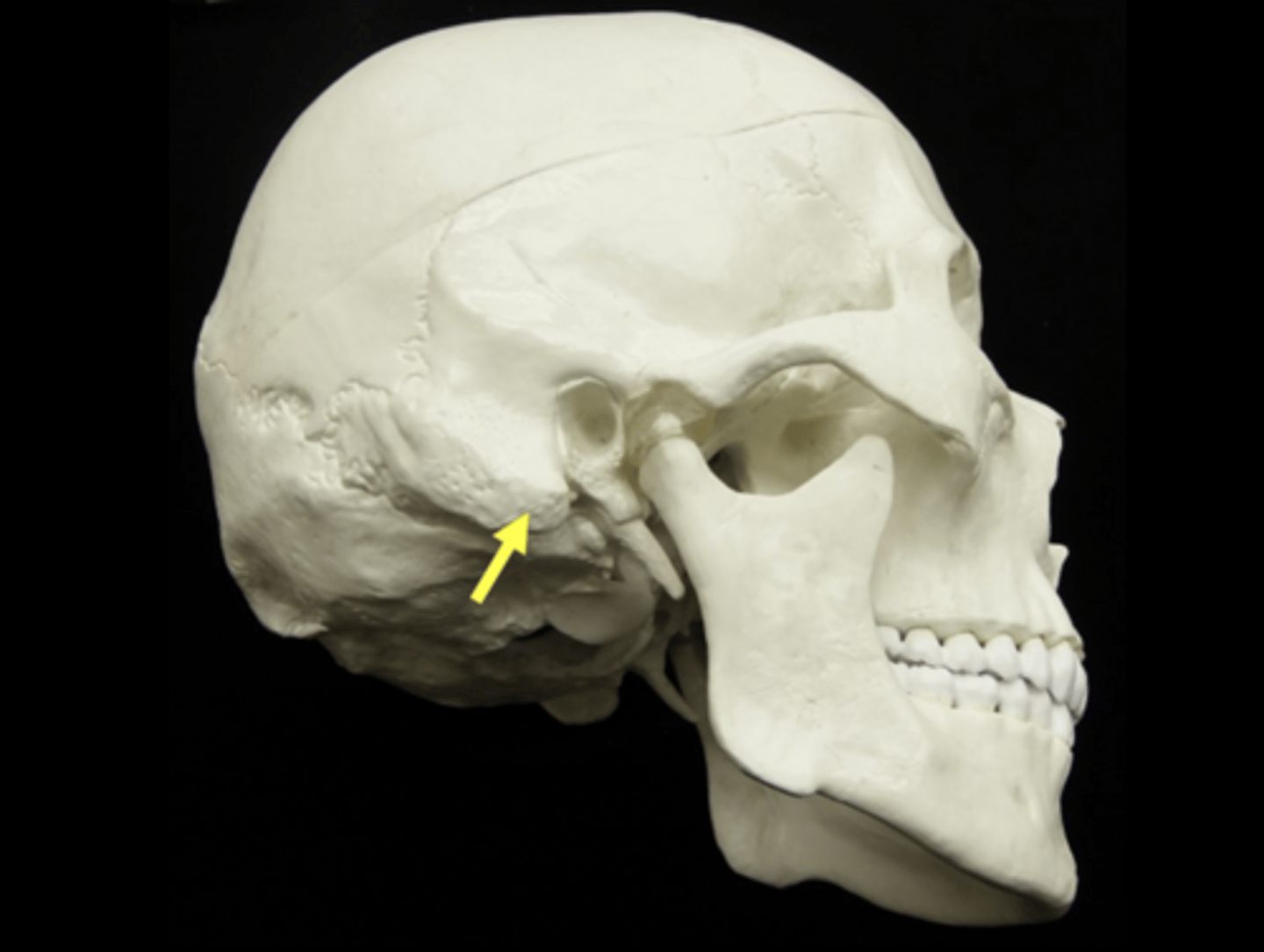 <p>name the bone and bone feature</p>