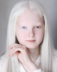 <p>genetic disorder that affects the skin, in which there is no melanin production</p>