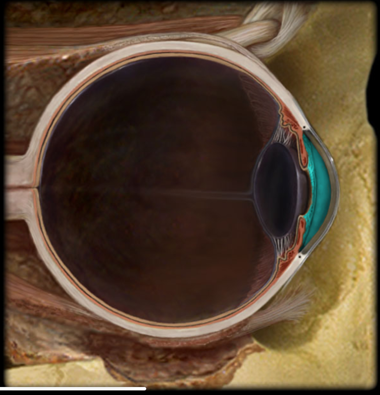 <h4 collapsed="false" seolevelmigrated="true"><strong>Location:</strong></h4><ul><li><p>Anterior cavity of eye</p></li><li><p>Between cornea and iris</p></li></ul><h4 collapsed="false" seolevelmigrated="true"><strong>Description:</strong></h4><ul><li><p>Subdivision of anterior cavity</p></li><li><p>Filled with aqueous humor</p></li></ul><h4 collapsed="false" seolevelmigrated="true"><strong>Comment:</strong></h4><ul><li><p>Aqueous humor produced in posterior chamber; passes through pupil; enters anterior chamber; reabsorbed into venous system through scleral venous sinus (canal of Schlemm)</p></li></ul>