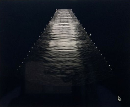 <p>What type of transducer produced the image?</p><p>a. sector phased array <br>b. linear sequential array <br>c. curved sequential array <br>d. vector phased array</p>