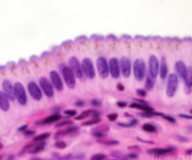 <p>What kind of epithelial tissue is this?</p>