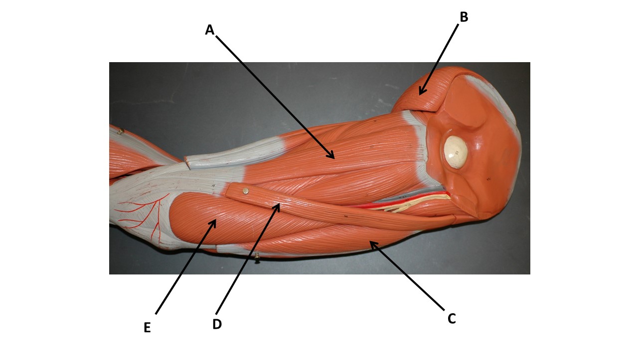 <p>What is the origin of the muscle labeled C? </p>