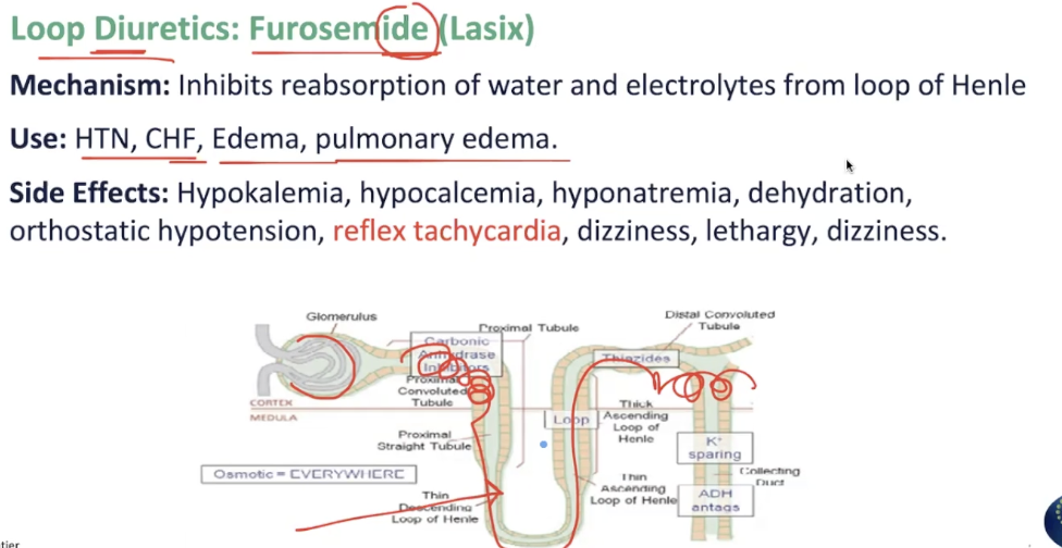 <ul><li><p>usually, some water and electrolytes are re-absorbed into the body at the loop of Henle, but loop diuretics act on the loop of Henle </p></li><li><p>if loop diuretics act on the loop of Henle, this means they prohibit the reabsorption, then there is no water or electrolytes, they are flushed/excreted </p></li></ul><p>LOOP diuretics = LOOP of HENLE</p><ul><li><p>use</p><ul><li><p>HTN, CHF, edema, pulmonary edema </p></li></ul></li></ul><p></p>