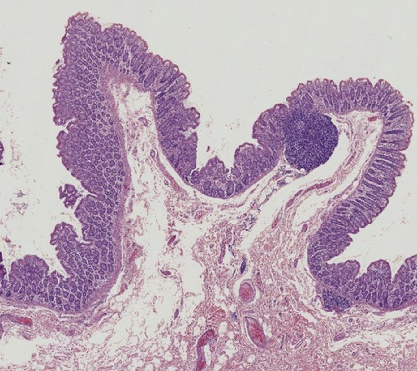 <p>Name the organ</p>