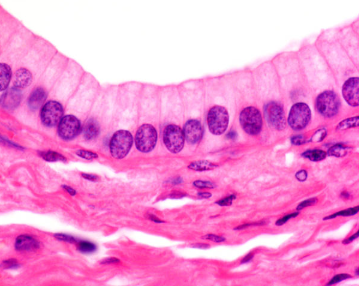 <ul><li><p>single layer of tall cells </p></li><li><p>often includes mucus producing goblet cells</p></li><li><p>lines most of digestive tract, gallbladder, uterus, and uterine tubes </p></li><li><p>small bronchi and bronchioles </p></li></ul><p></p>