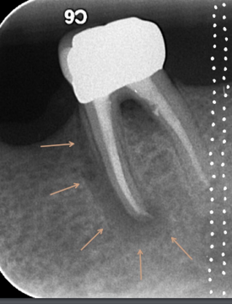 <p>ID the problem:</p>